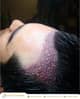 Slider image (3) Este Estanbul - Hair Transplant Clinic Istanbul, Turkey